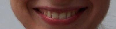 sorriso
